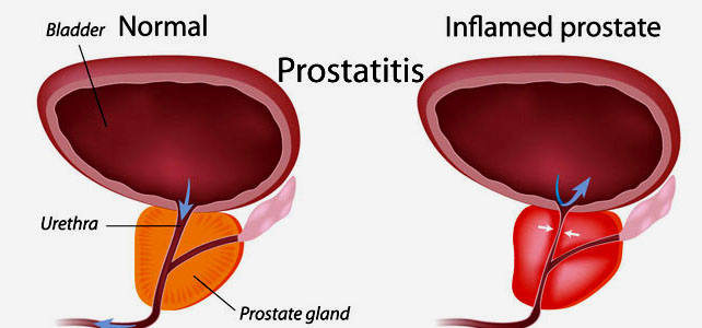 Hasil gambar untuk prostate gland