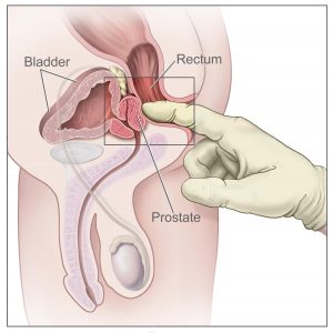Image of prostate massage