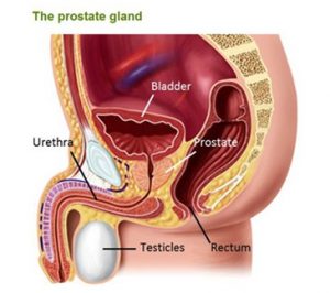 Prostatitis Pain